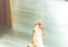 PLANTARNI FASCITIS Što je to i kako s ovom boli?